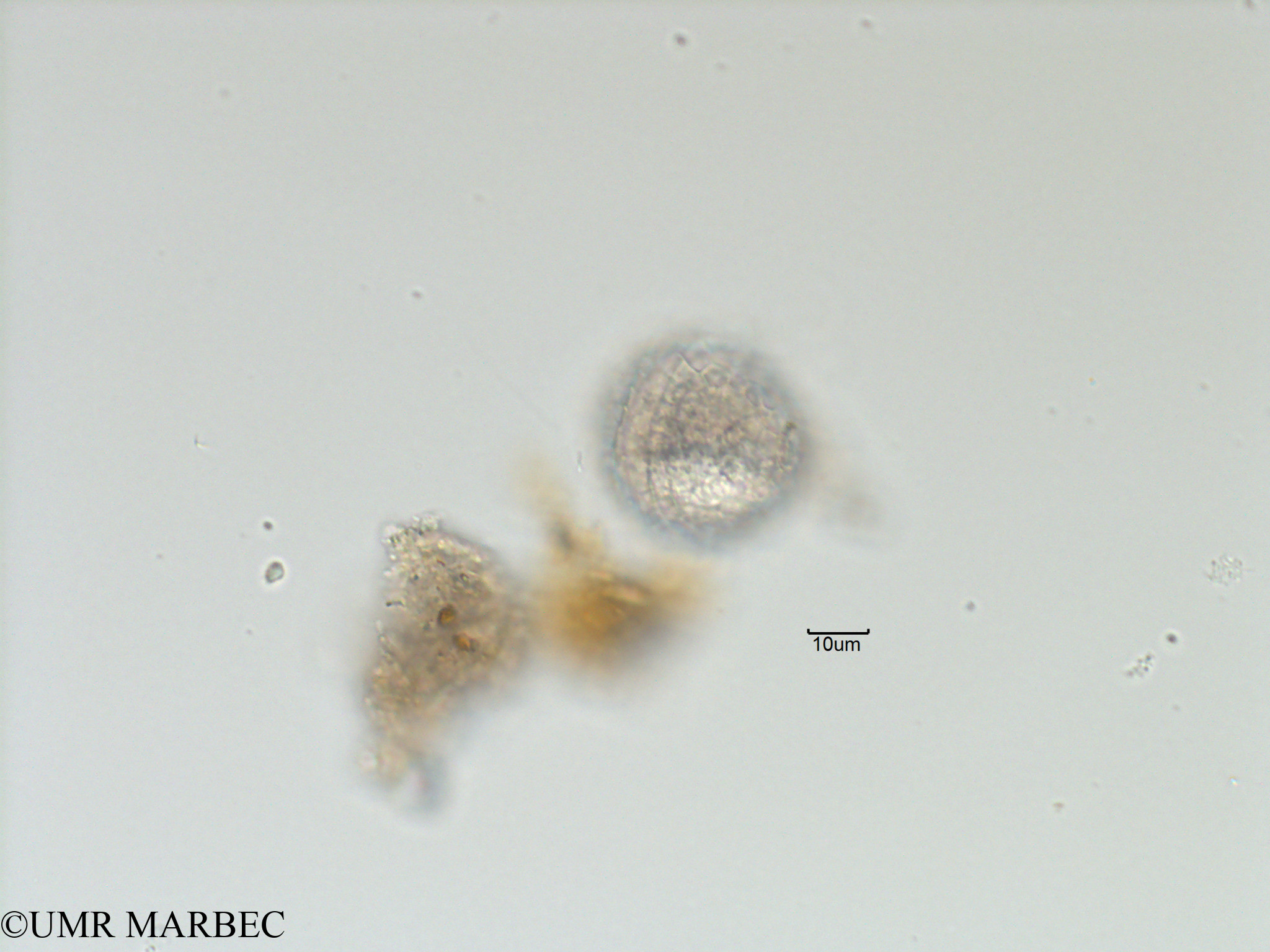 phyto/Bizerte/bizerte_bay/RISCO November 2015/Protoceratium reticulatum syn. gonyaulax grindleyi (Baie_T5-C2-Protoceratium reticulatum-4)(copy).jpg